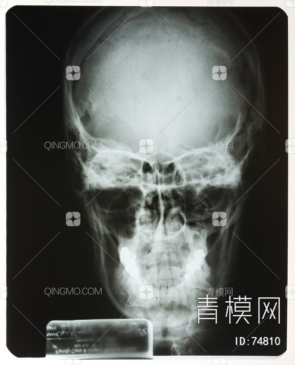 X射线-头贴图下载【ID:74810】
