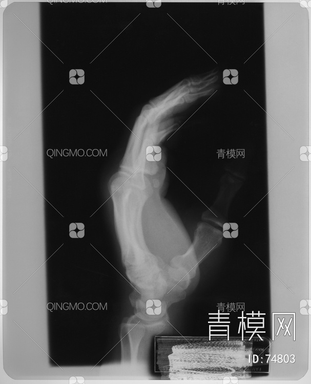 X射线-手贴图下载【ID:74803】