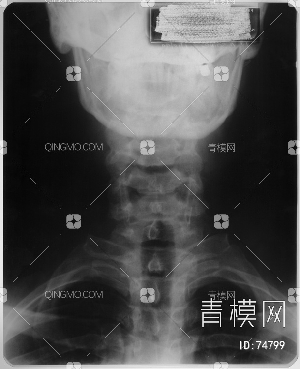 X射线-头贴图下载【ID:74799】