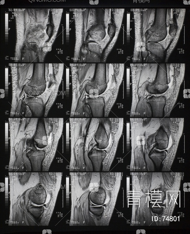 X射线-CT磁共振成像贴图下载【ID:74801】