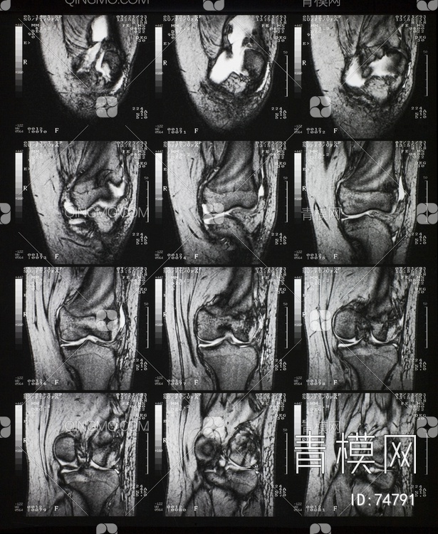X射线-CT磁共振成像贴图下载【ID:74791】