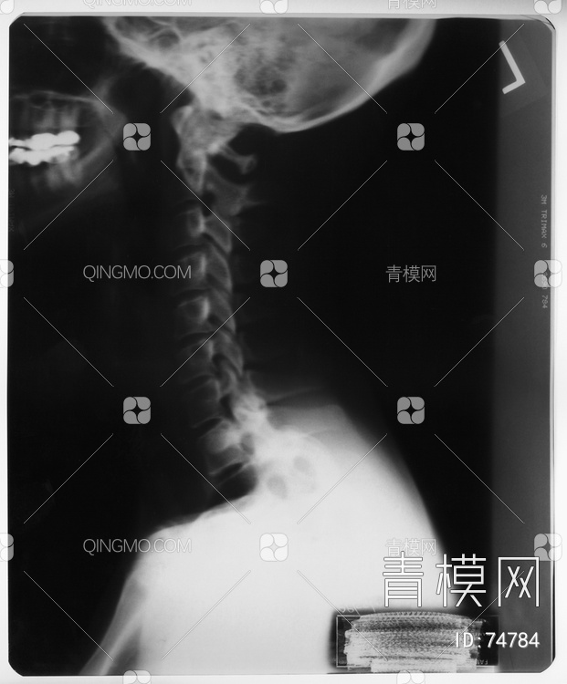 X射线-头贴图下载【ID:74784】