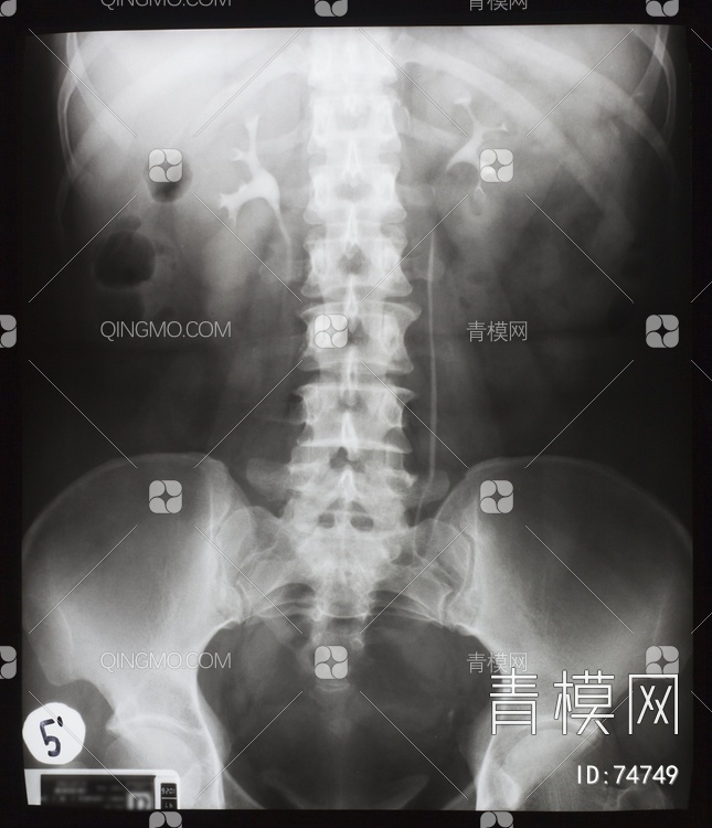 X射线-盆腔贴图下载【ID:74749】