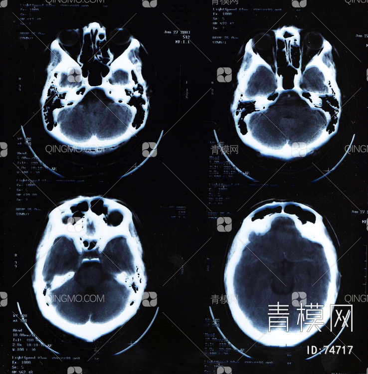 X射线-CT磁共振成像贴图下载【ID:74717】