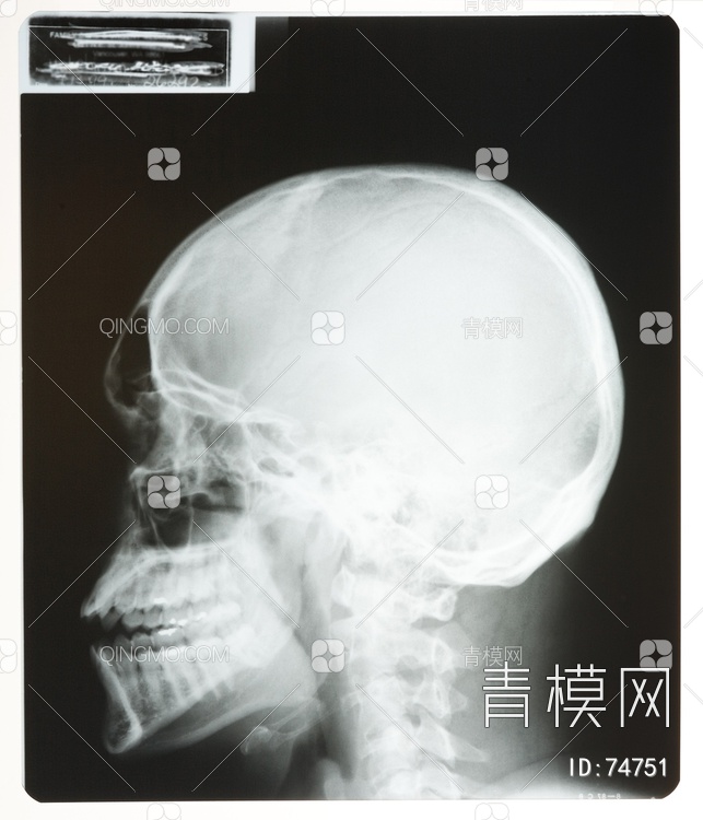 X射线-头贴图下载【ID:74751】