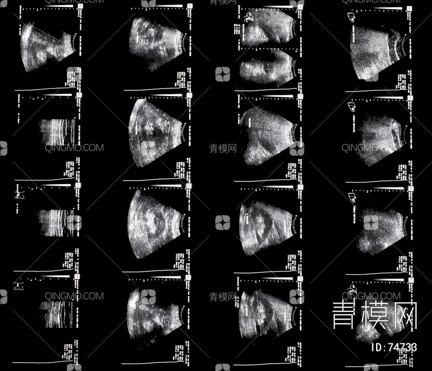 X射线-CT磁共振成像贴图下载【ID:74733】