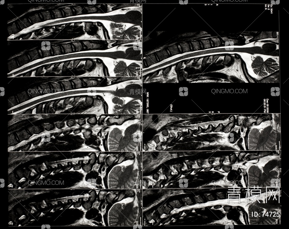X射线-CT磁共振成像贴图下载【ID:74725】