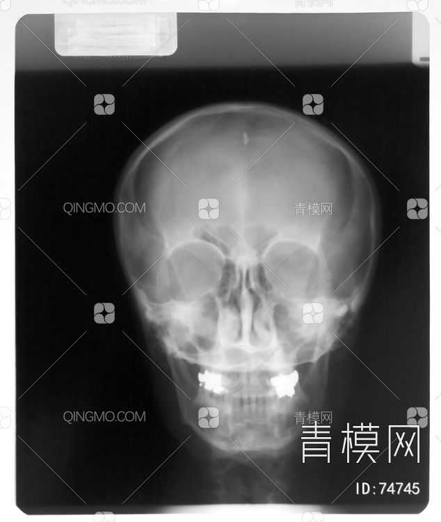 X射线-头贴图下载【ID:74745】
