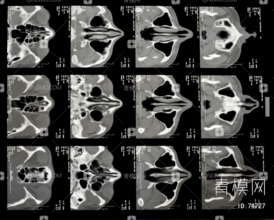 X射线-CT磁共振成像贴图下载【ID:74727】