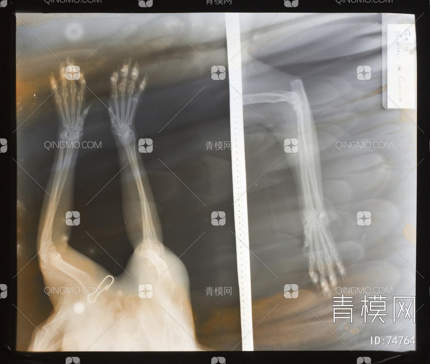 X射线-动物贴图下载【ID:74764】