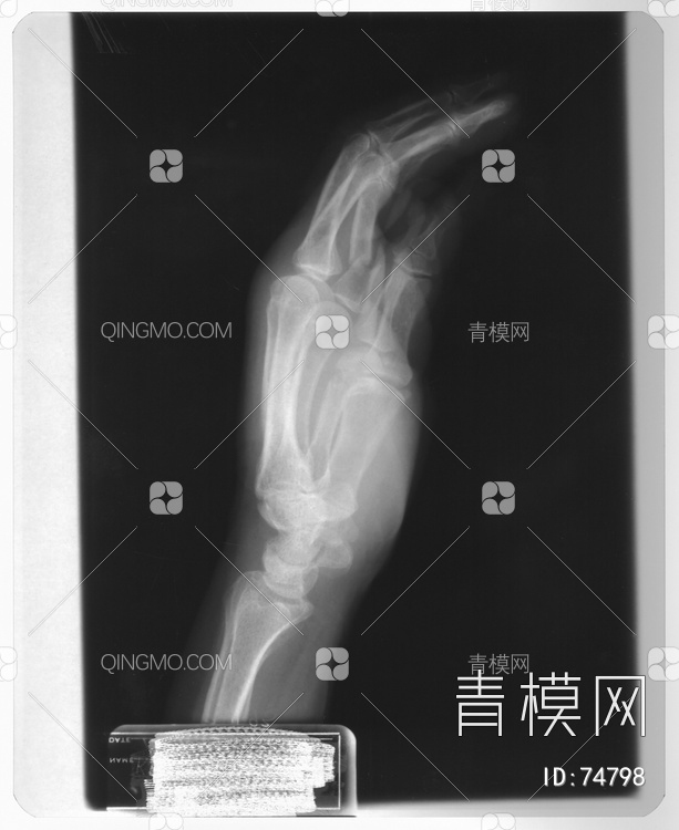 X射线-手贴图下载【ID:74798】