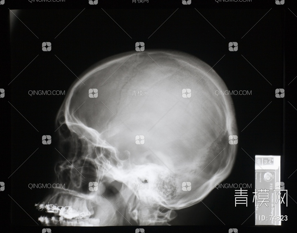 X射线-头贴图下载【ID:74823】