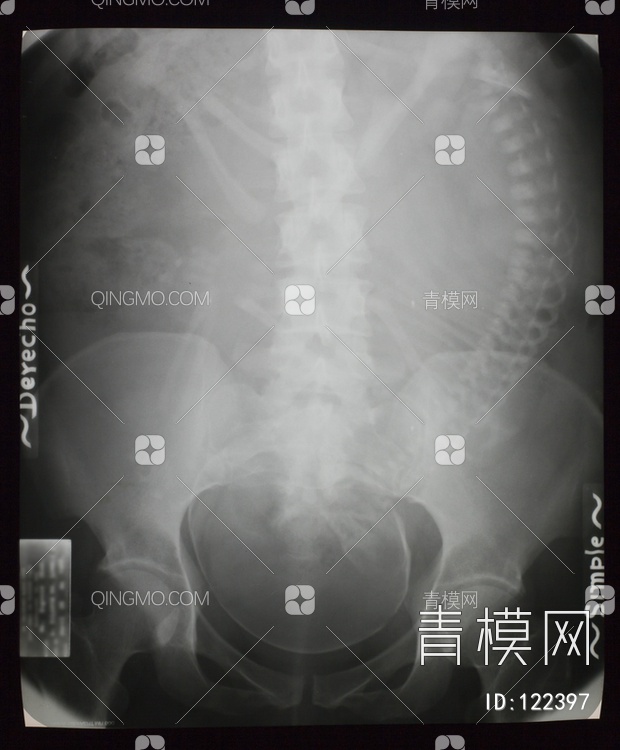 盆腔X射线贴图下载【ID:122397】