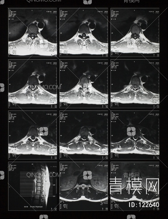 CT磁共振成像X射线贴图下载【ID:122640】