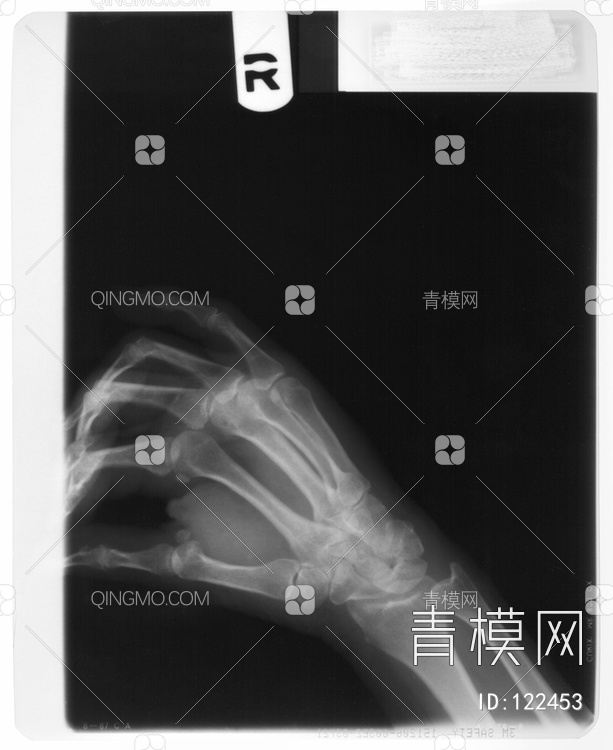 手X射线贴图下载【ID:122453】