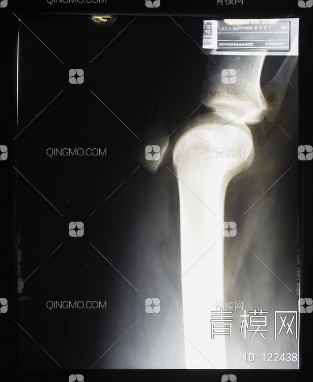 膝关节X射线贴图下载【ID:122438】
