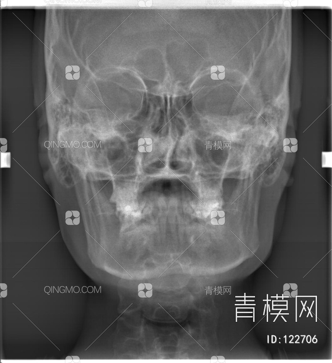 头X射线贴图下载【ID:122706】