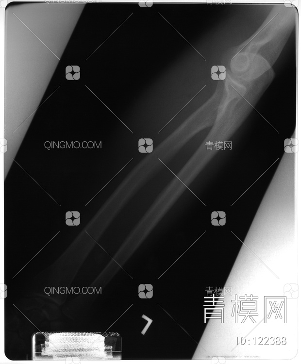 手关节X射线贴图下载【ID:122388】