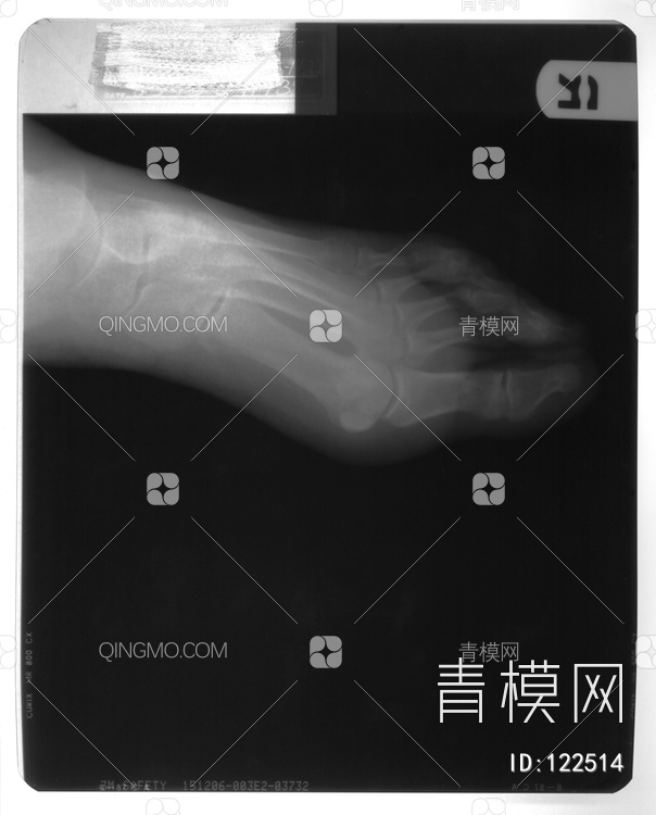 脚X射线贴图下载【ID:122514】