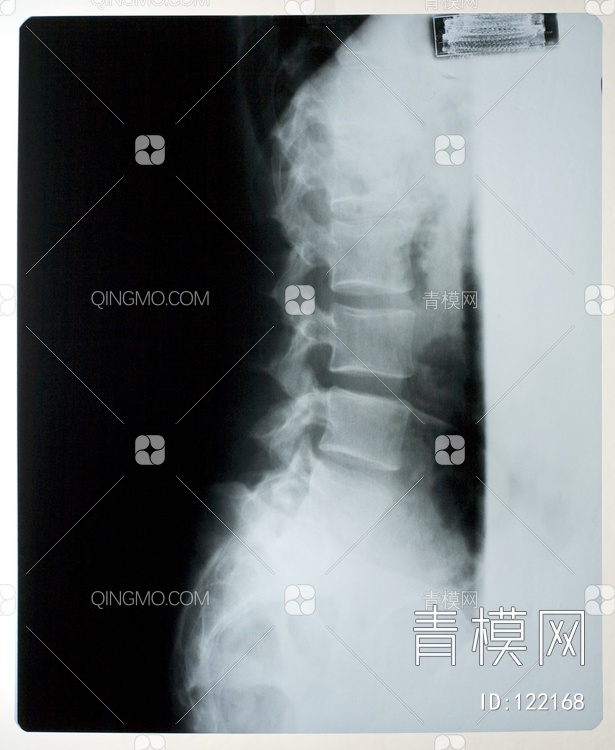 胸部X射线贴图下载【ID:122168】