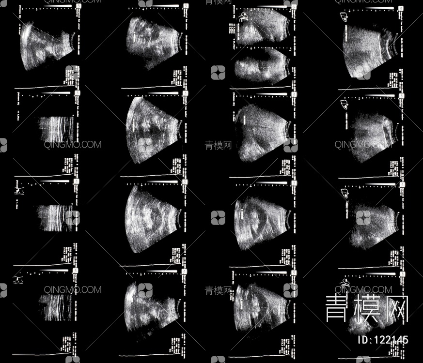 CT磁共振成像X射线贴图下载【ID:122145】