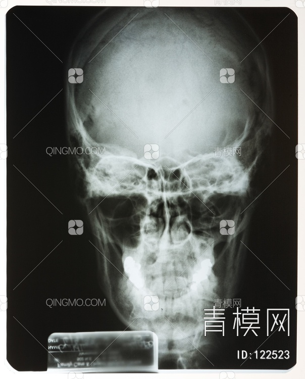 头X射线贴图下载【ID:122523】