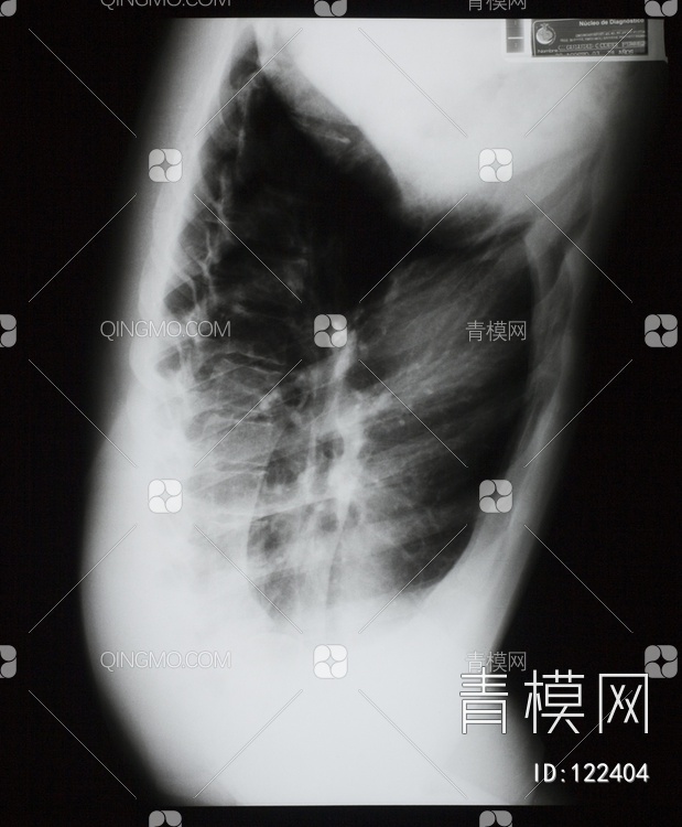 胸部X射线贴图下载【ID:122404】