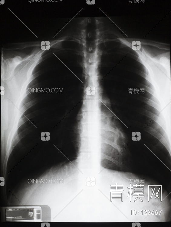 胸部X射线贴图下载【ID:122667】