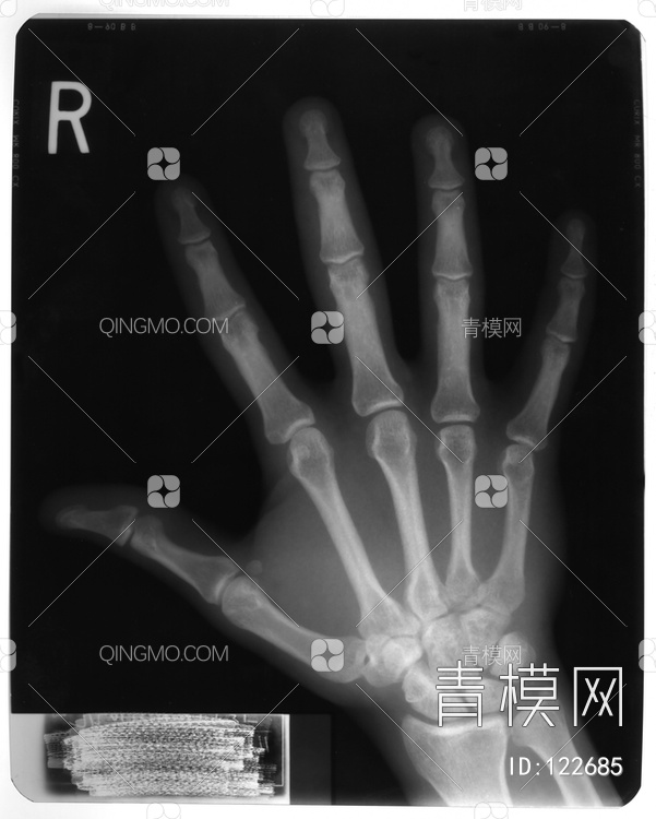 手X射线贴图下载【ID:122685】