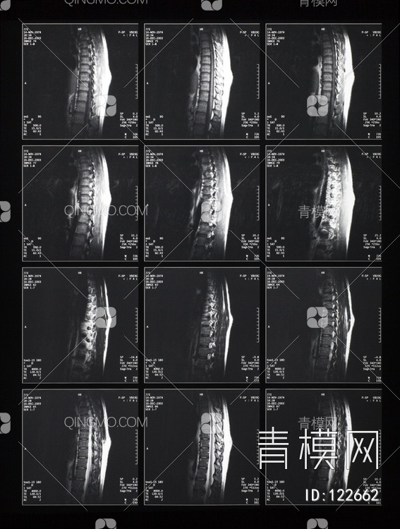 CT磁共振成像X射线贴图下载【ID:122662】