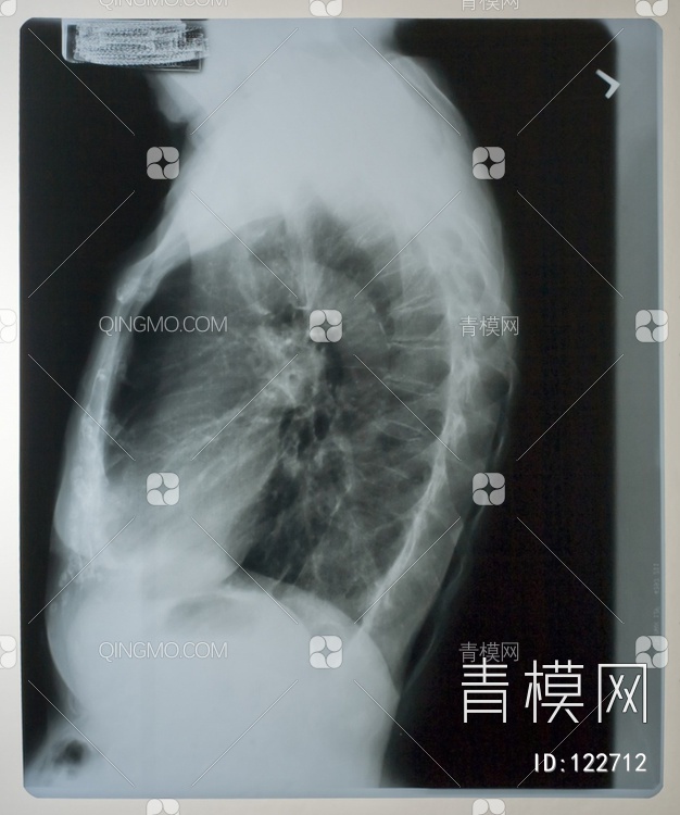 胸部X射线贴图下载【ID:122712】