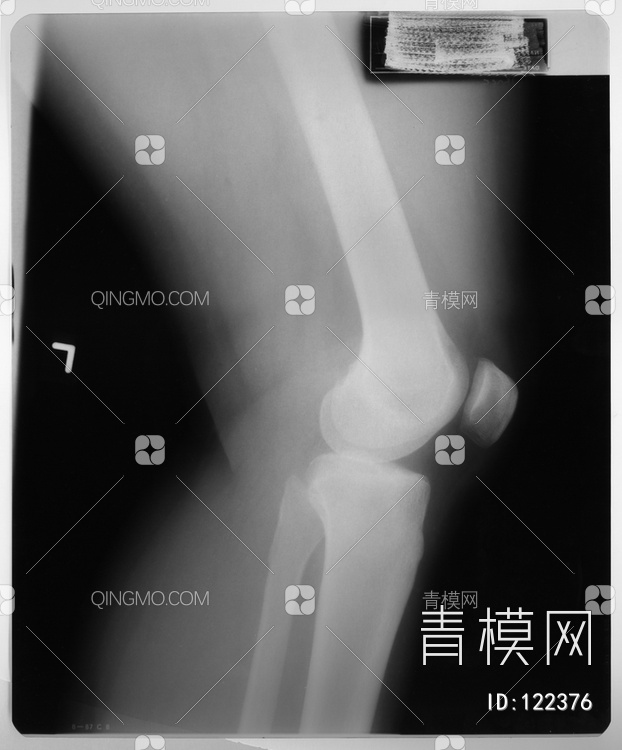膝关节X射线贴图下载【ID:122376】