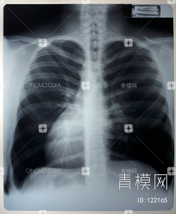胸部X射线贴图下载【ID:122165】