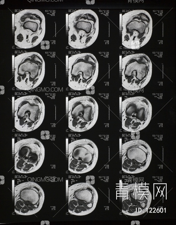 CT磁共振成像X射线贴图下载【ID:122601】