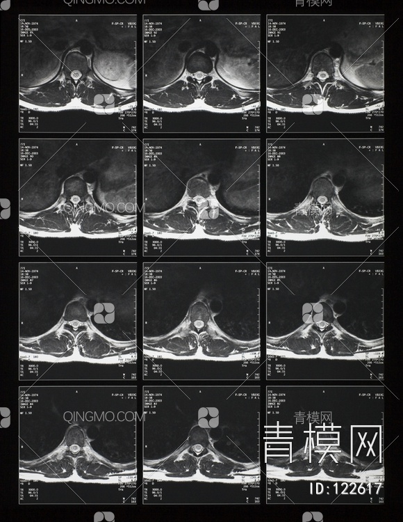 CT磁共振成像X射线贴图下载【ID:122617】