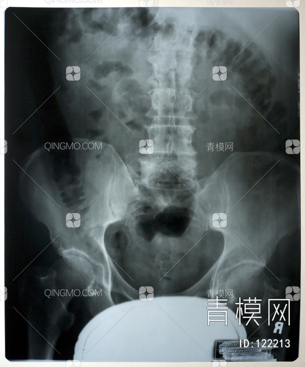 盆腔X射线贴图下载【ID:122213】