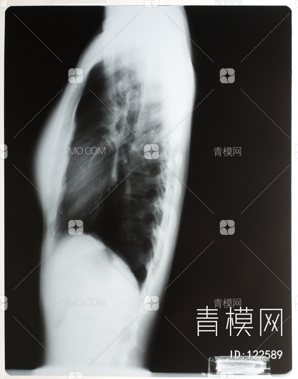 胸部X射线贴图下载【ID:122589】