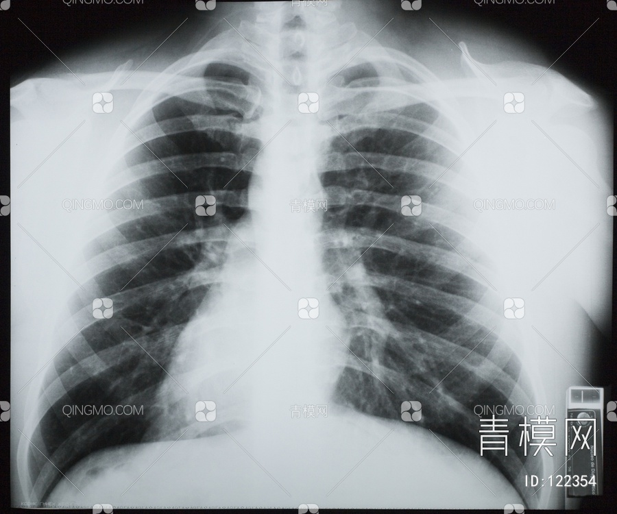 胸部X射线贴图下载【ID:122354】