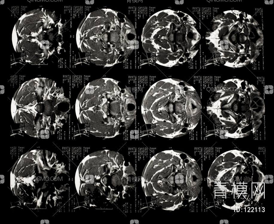 CT磁共振成像X射线贴图下载【ID:122113】