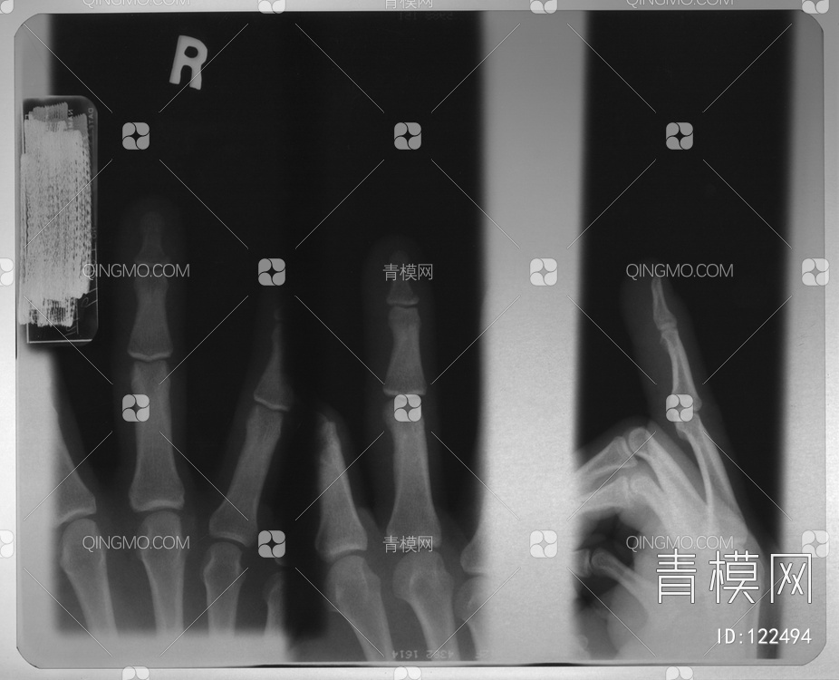 手X射线贴图下载【ID:122494】