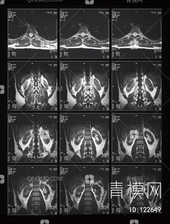 CT磁共振成像X射线贴图下载【ID:122649】