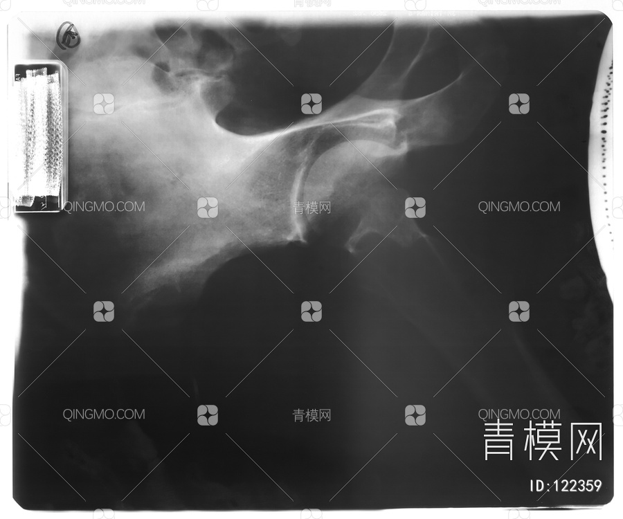 盆腔X射线贴图下载【ID:122359】