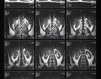 CT磁共振成像X射线